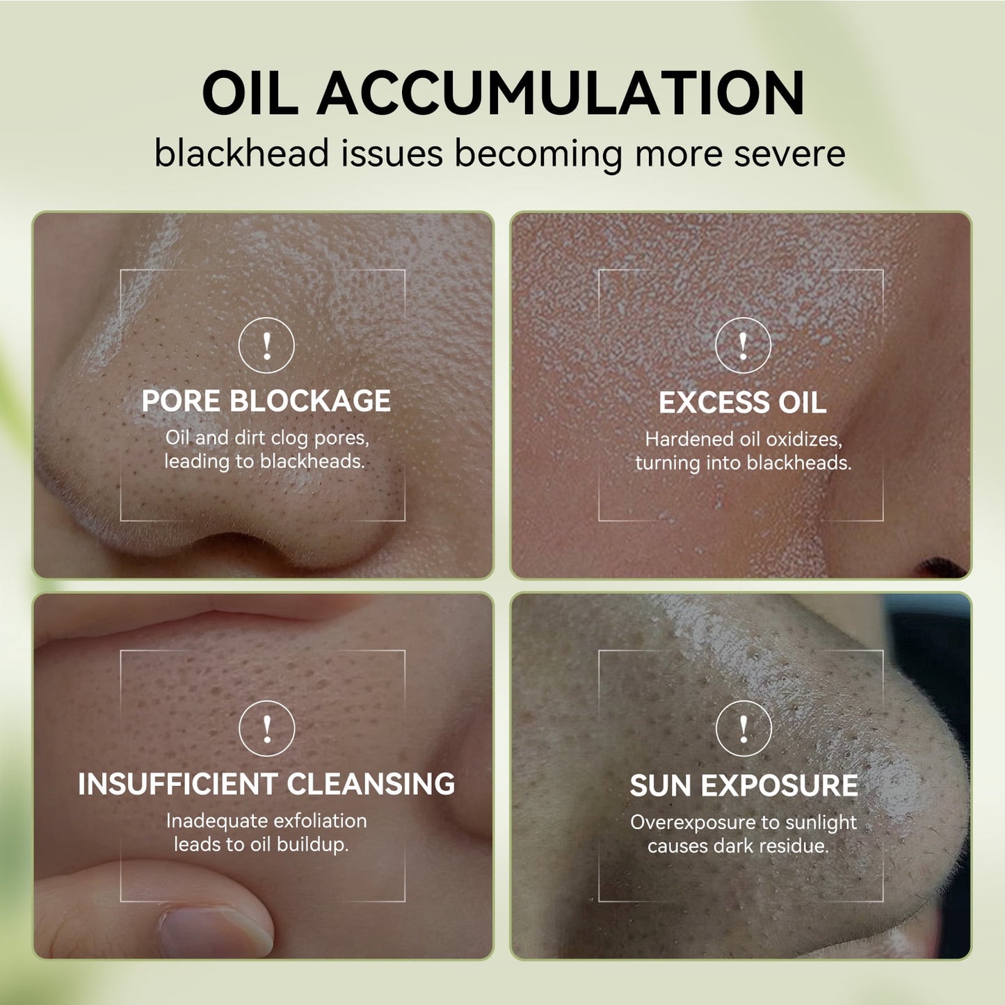 Transform Your Skin with the 3-in-1 Blackhead Removal Set: Bamboo Charcoal Pore Strips & Pore Minimizing Serum for a Fresh, Clean Face!